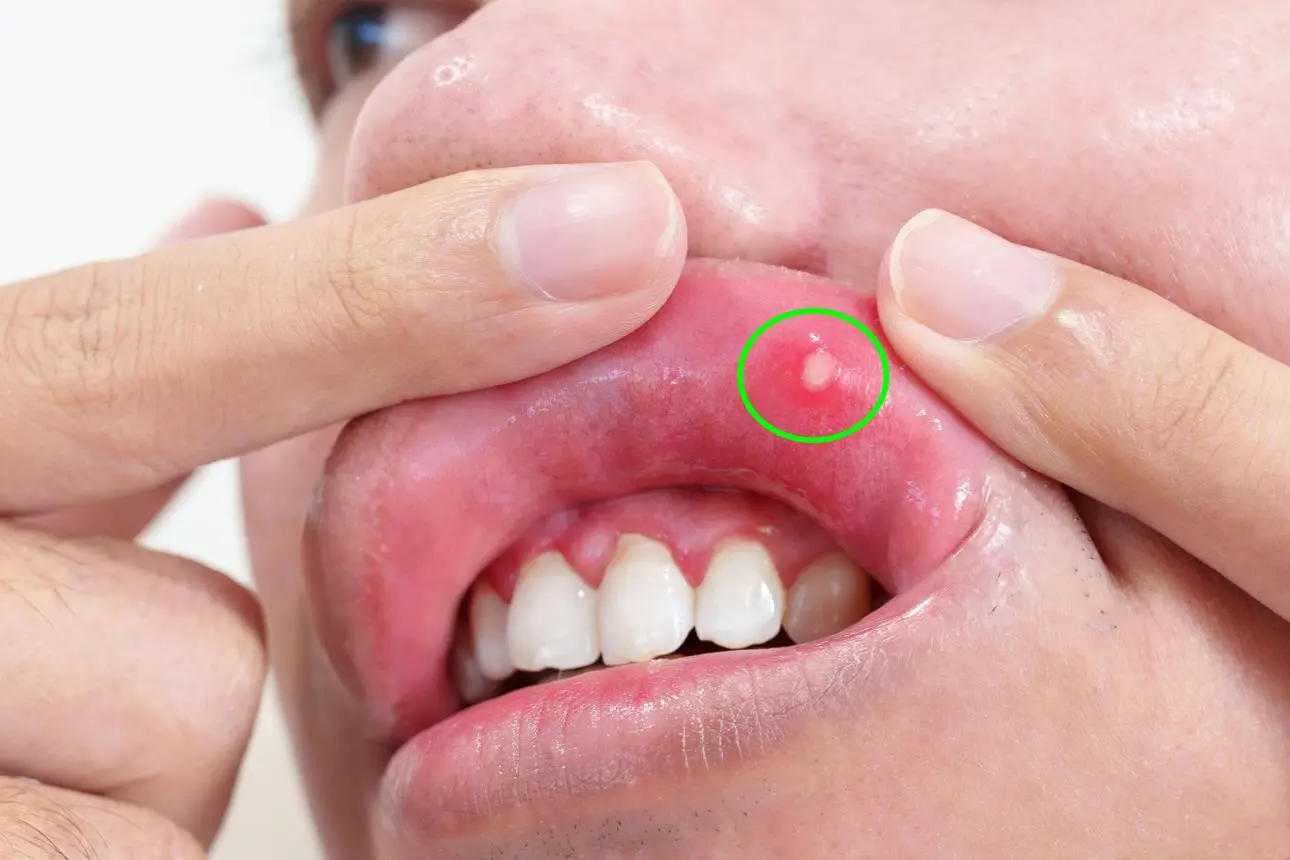 DentLink